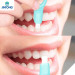 Magic Teeth Whitening Kit Better Than Toothpaste Free Market United States